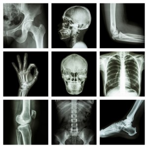 What is x-ray?